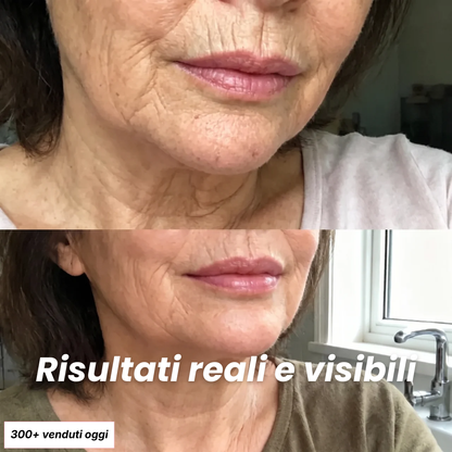 Stick Rimpolpante Bio-Collagene PDRN