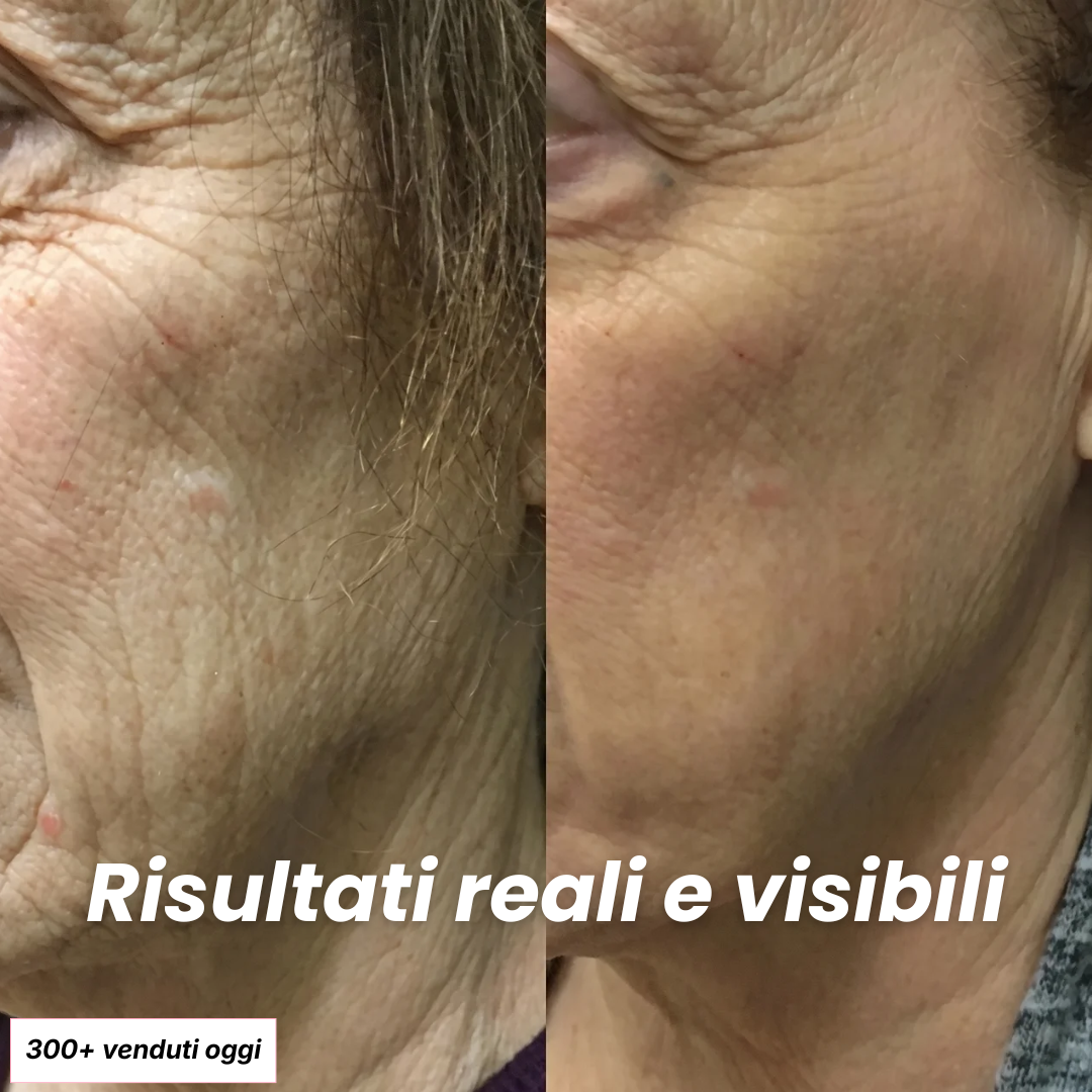 Stick Rimpolpante Bio-Collagene PDRN