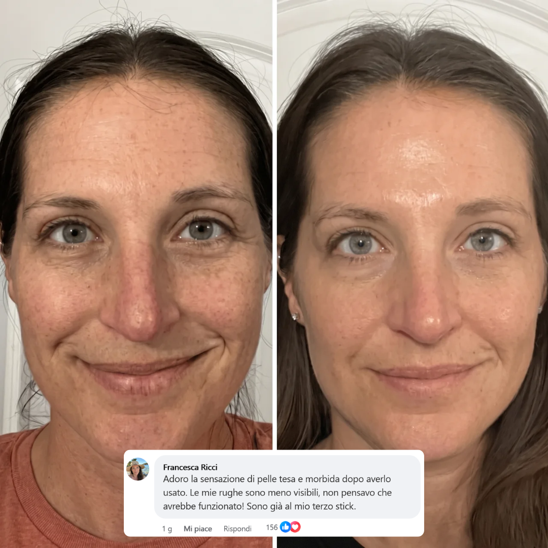 Stick Rimpolpante Bio-Collagene PDRN