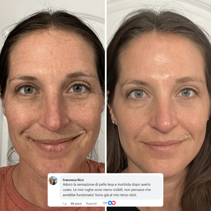 Stick Rimpolpante Bio-Collagene PDRN