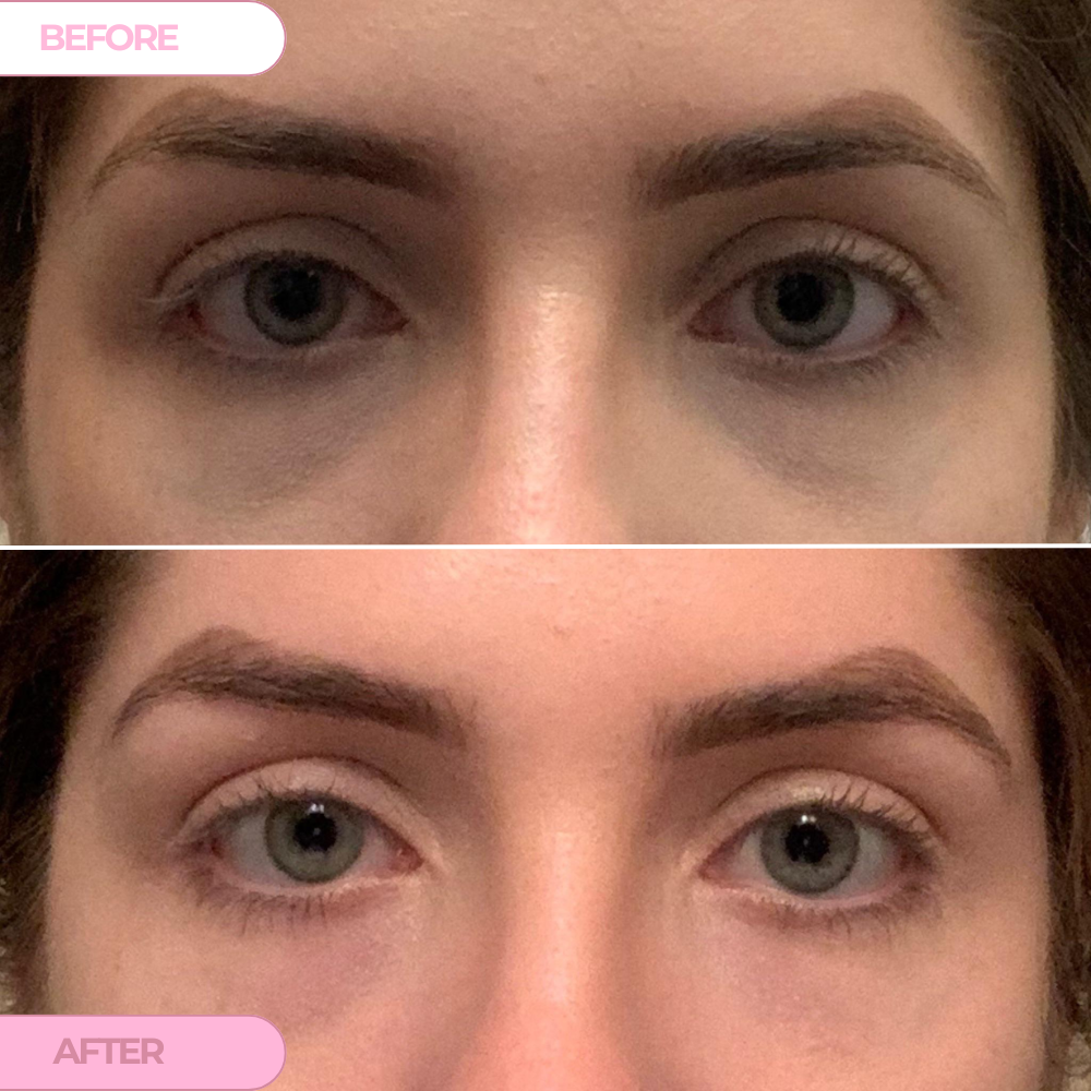 PDRN Collagen Renewal Eye Patches