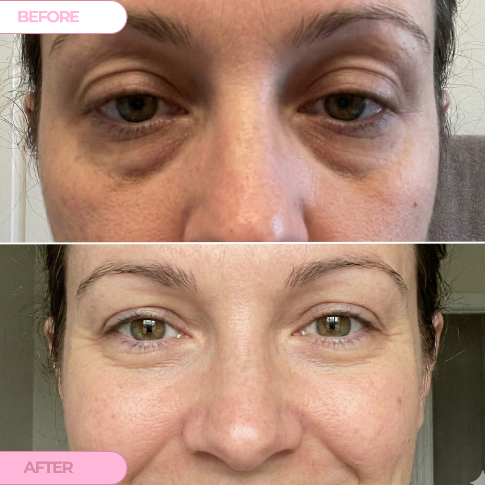 PDRN Collagen Renewal Eye Patches