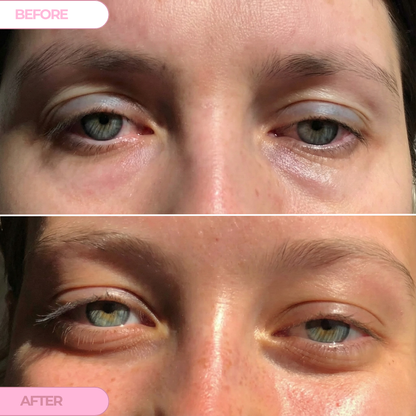 PDRN Collagen Renewal Eye Patches
